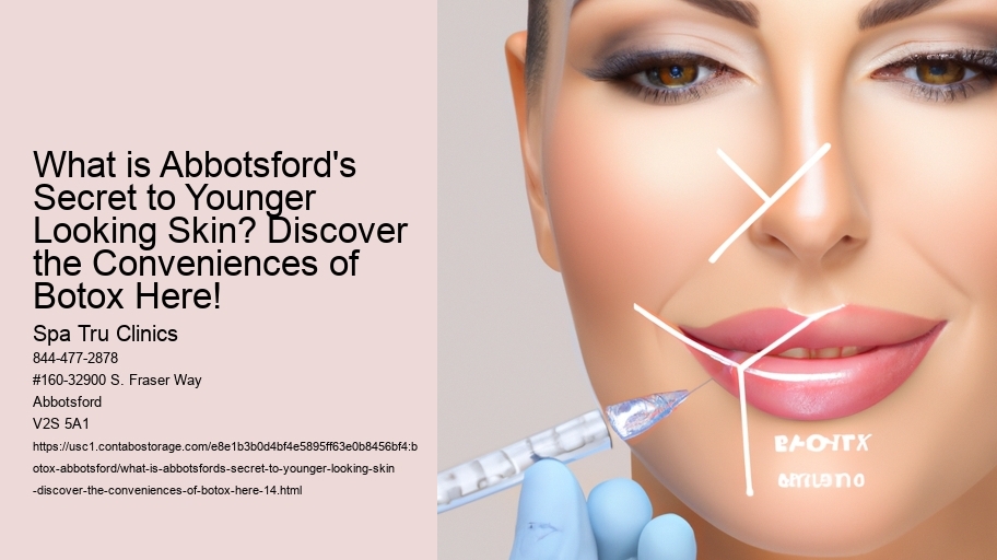 What is Abbotsford's Secret to Younger Looking Skin? Discover the Conveniences of Botox Here!