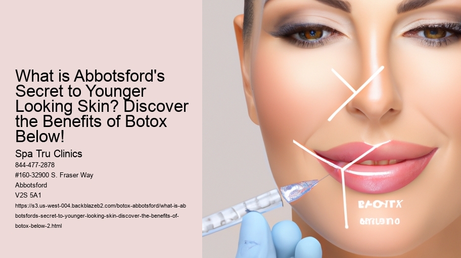 What is Abbotsford's Secret to Younger Looking Skin? Discover the Benefits of Botox Below!