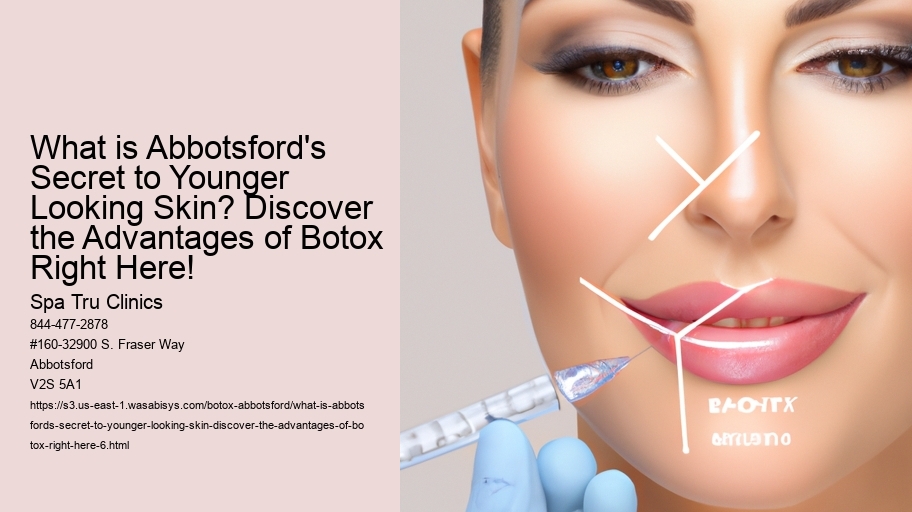 What is Abbotsford's Secret to Younger Looking Skin? Discover the Advantages of Botox Right Here!