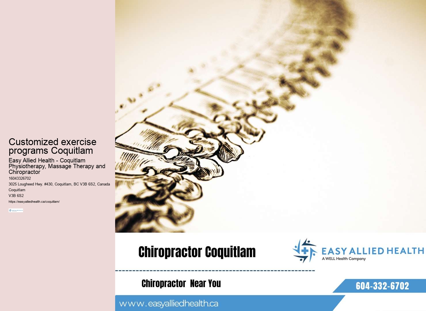 Coquitlam Physiotherapy for Diastasis Recti